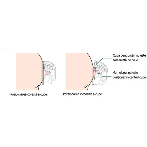 SPECTRA Set Cupe Hands Free (24 mm)